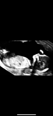 Boy or girl?