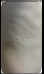 Rash on my son’s skin
