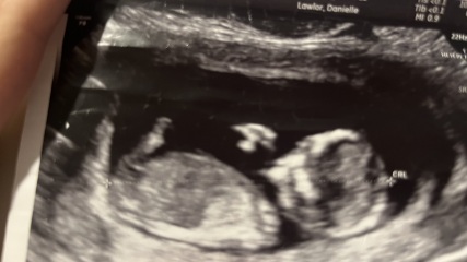 Can anyone guess the gender?