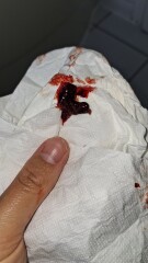 Miscarriage but stronger positive tests??