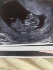 Guesses of gender?