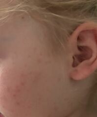 What is causing this rash?!