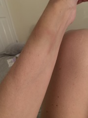 Really worried, grateful of opinions please!