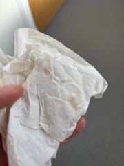 ? Bleeding in early pregnancy ? Chemical pregnancy