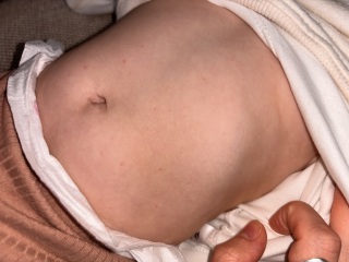 Does this look like chicken pox?