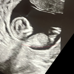13 weeks any guesses girl or boy?