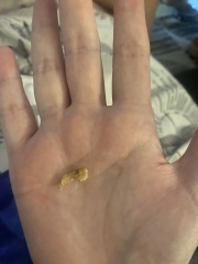 Who wants to see what came from my ear?