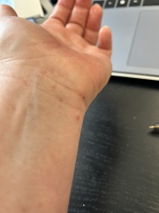 Is this actually dermatitis? Sooooo itchy!
