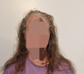Have I left it to late hair