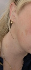 rash on neck and face does anyone know what this is