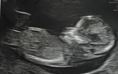 Boy or girl
