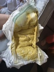 Is this poop normal?