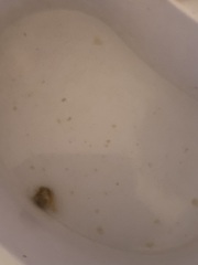 Who wants to see what came from my ear?