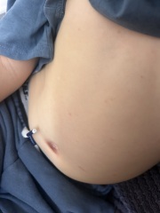 What are these spots on my son’s skin?