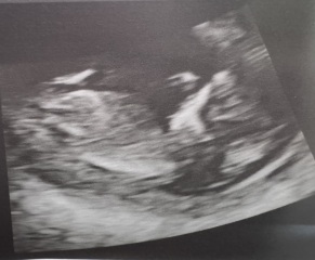 Gender guesses please