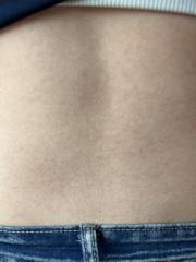 Can anyone identify this rash?