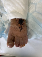 Healing? (apologies picture wound site hopefully inserted)