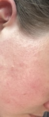 What is wrong with my skin😔 pics included