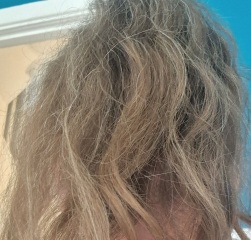 Have I left it to late hair