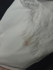 Implantation or period?