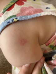 What does this look like?