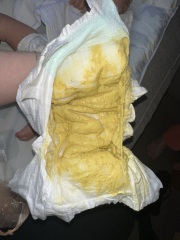 Is this poop normal?