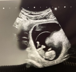 Due February 2026 ✨