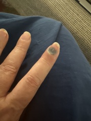 Slammed my finger in the door last night