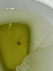 Implantation? Clots?