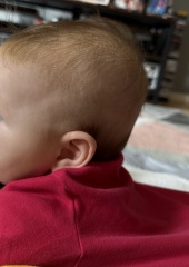 Does my baby look like she has a flat head?