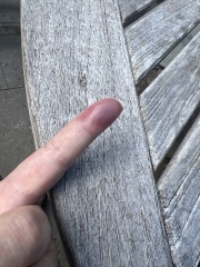 Slammed my finger in the door last night