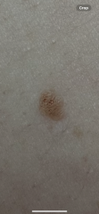 Mole