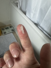 38 weeks losing mucus pluG? TMI PICTURE