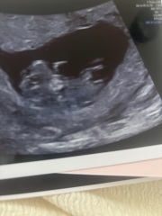 Guesses of gender?