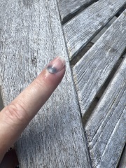 Slammed my finger in the door last night