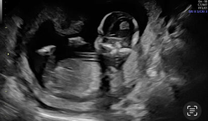 It’s a BOY! But sooo confused about what the scan picture shows…please help!