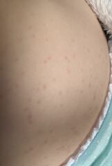 What is causing this rash?!