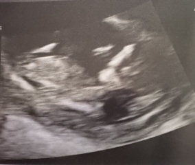 Anyone care to guess the gender?