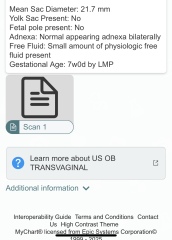 TMI Photos - Brown discharge 6/7 weeks. 