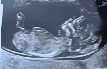 Boy or girl gender guesses 12+4