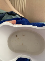 Can anyone recommend a home ear suctioning device please?