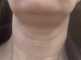 Crepe neck help!