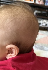 Does my baby look like she has a flat head?
