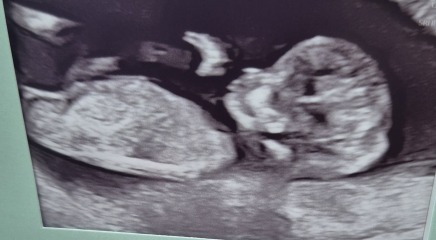 Gender Guesses?