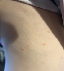 What are these spots on my son’s skin?