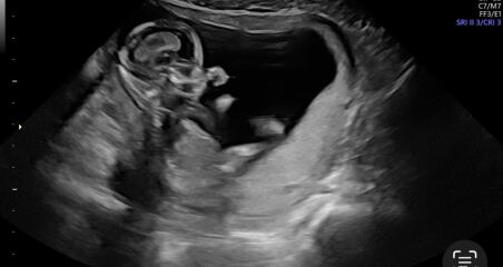It’s a BOY! But sooo confused about what the scan picture shows…please help!