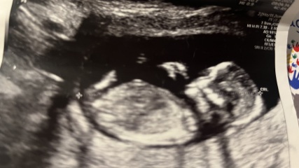 Can anyone guess the gender?