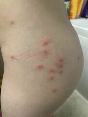 What are these spots on my DD?