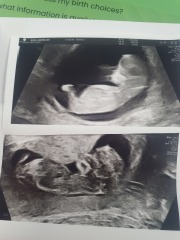 12 weeks 1 day