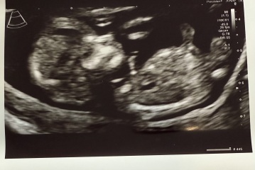 Nub / Skull theory guesses